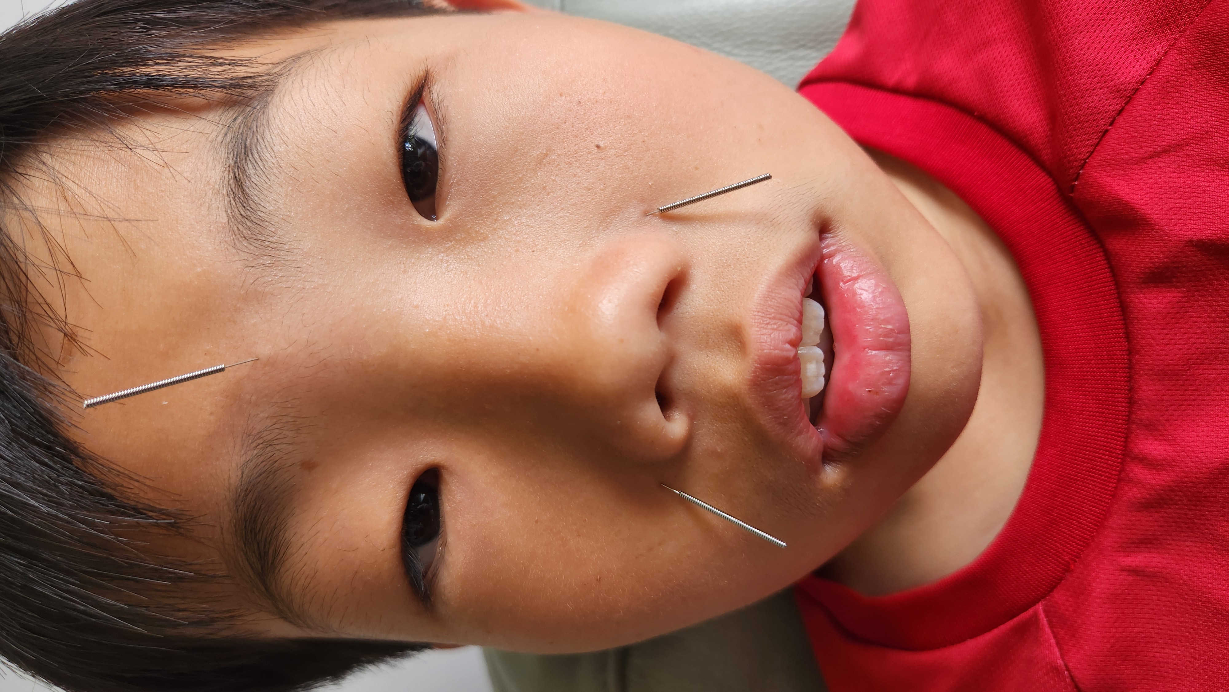 Nasal-care session photograph 2 at RootCare