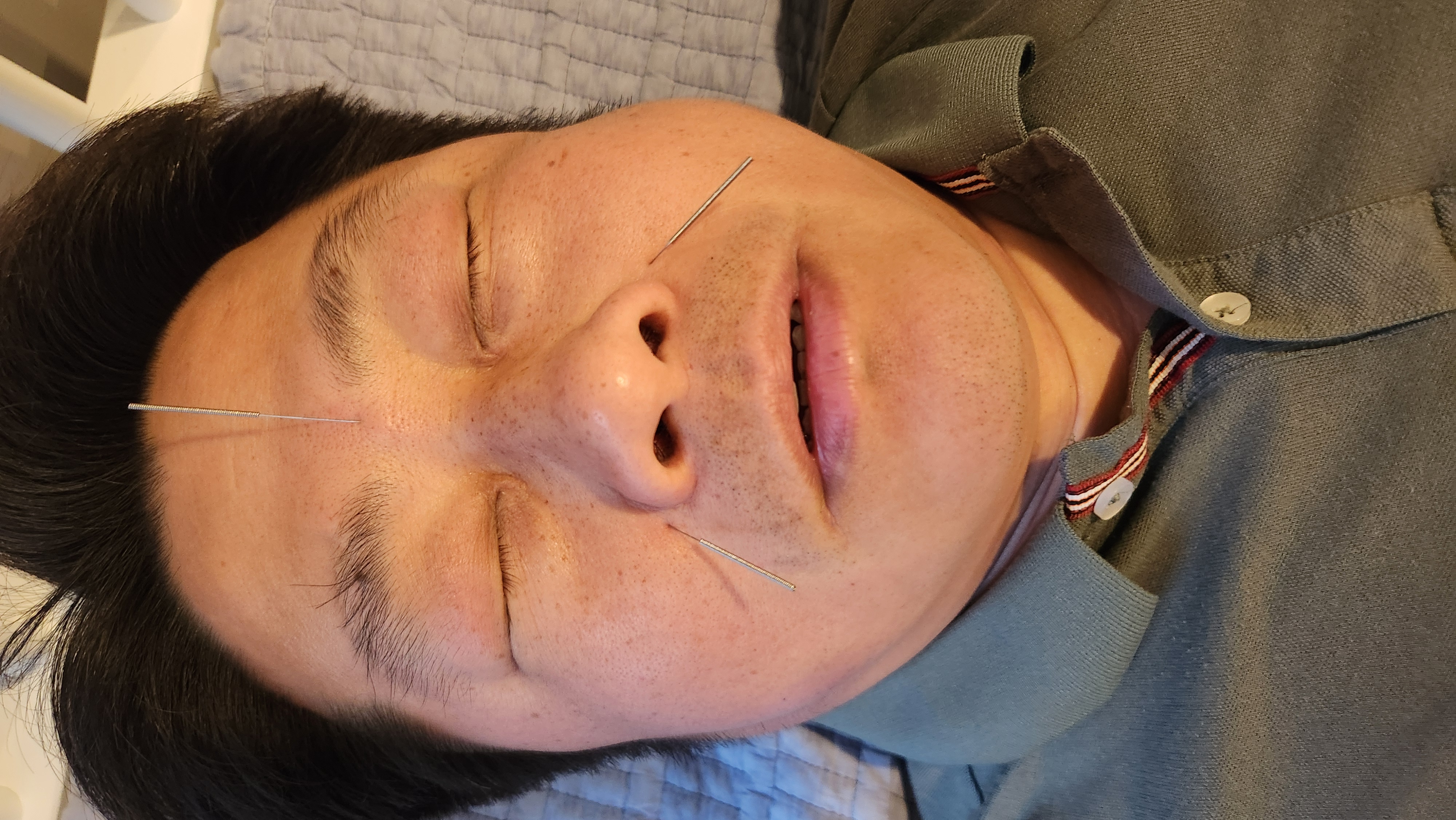Nasal-care session photograph 3 at RootCare