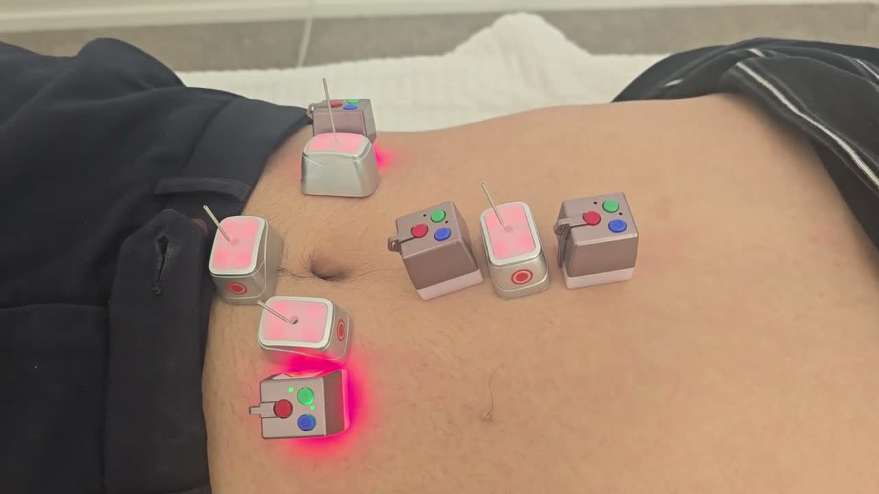 A still from the digestive-care session. Treatment is adjusted to your comfort.