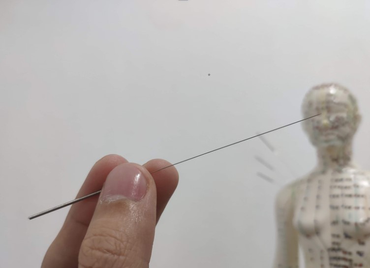Dry needling and acupuncture comparison guide image