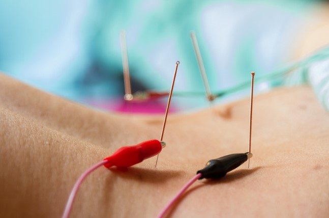 Electro-acupuncture treatment