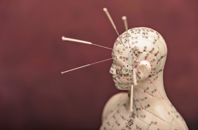 Acupuncture treatment close-up