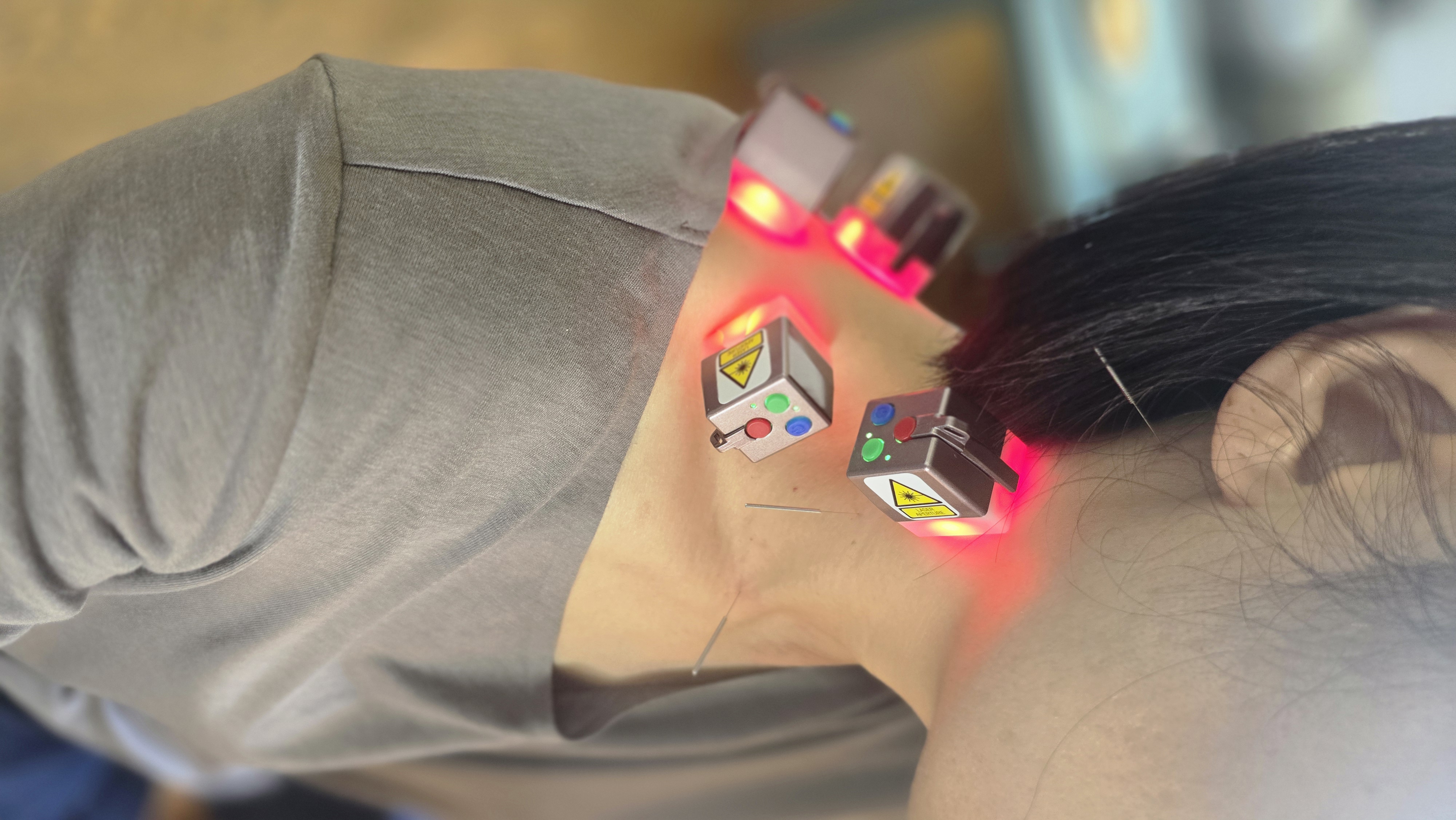 Shoulder pain acupuncture guide image